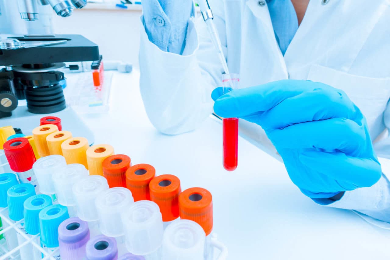 Pre-implantatie genetische diagnose bij IVF Riga